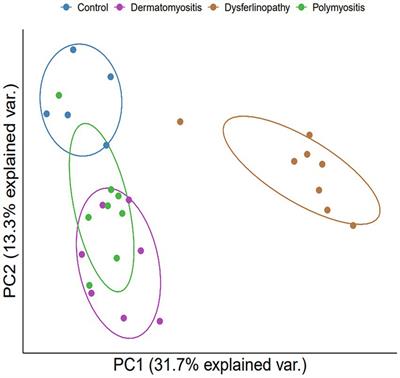 Transcriptome analysis of skeletal muscle in dermatomyositis, polymyositis, and dysferlinopathy, using a bioinformatics approach